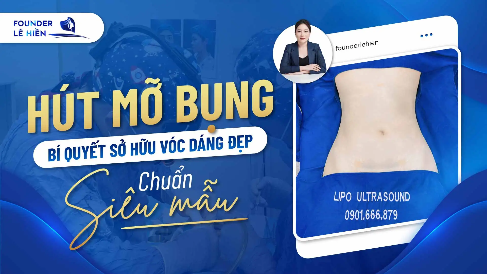 Hút Mỡ Bụng - Bí Quyết Sở Hữu Vóc Dáng Đẹp Chuẩn Siêu Mẫu