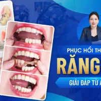 Phuc-Hoi-Thao-Lap-Rang-Gia-Giai-Dap-Tu-A-Den