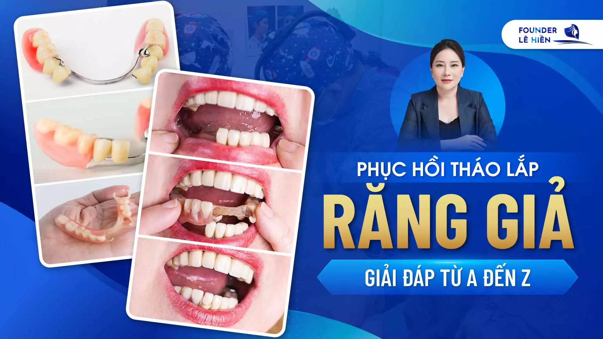 Phục Hồi Tháo Lắp Răng Giả: Giải Đáp Từ A Đến Z