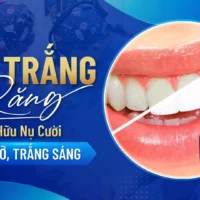 Tay-Trang-Rang-So-Huu-Nu-Cuoi-Rang-Ro-Trang-Sang.webp