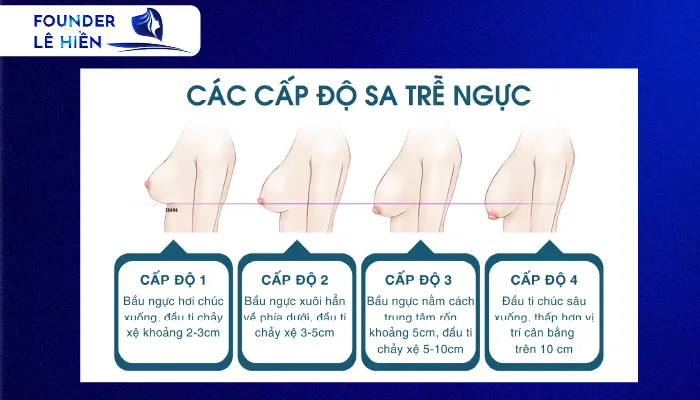 Treo ngực sa trễ