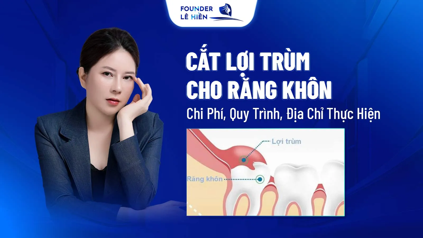 Cat Loi Trum Cho Rang Khon Chi Phi Quy Trinh Dia Chi Thuc Hien 1