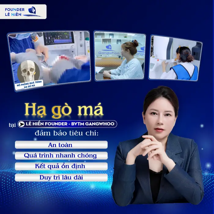 Hạ gò má