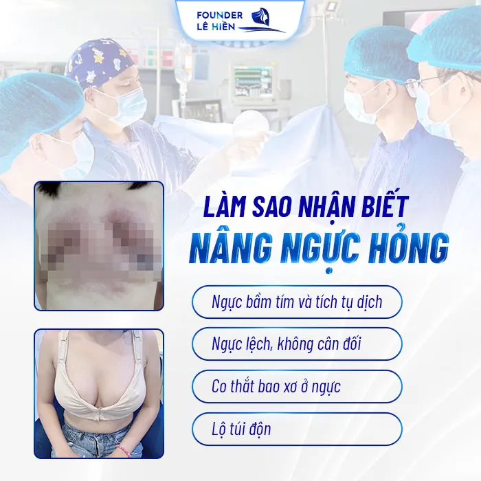 Sửa ngực hỏng