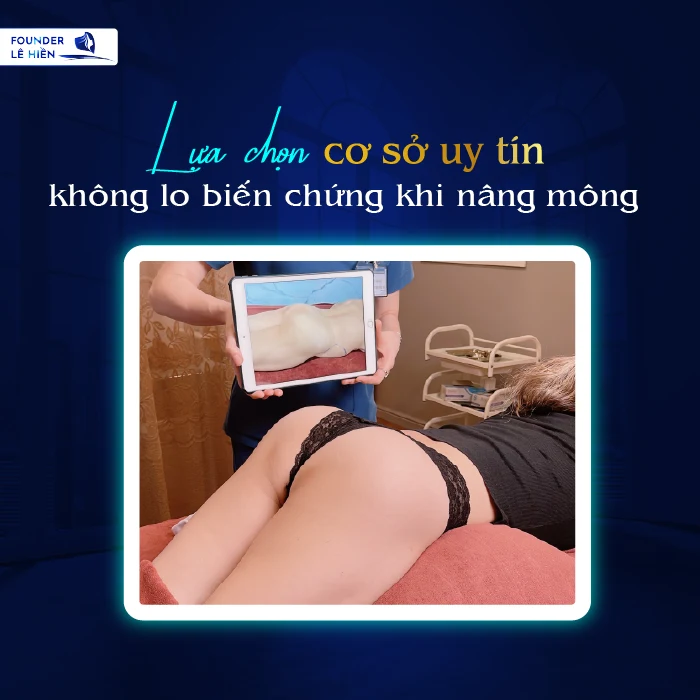 Lua chon co so uy tin khong lo bien chung khi nang mong 01