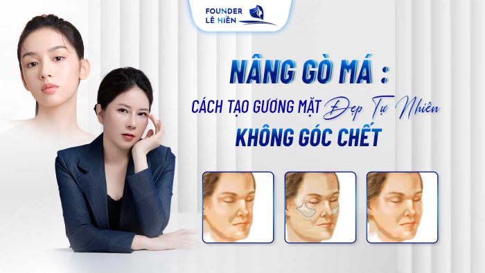 Nâng gò má: Cách Tạo Gương Mặt Đẹp Tự Nhiên, Không Góc Chết