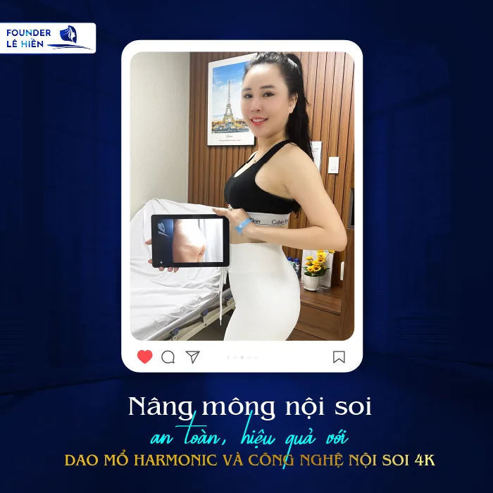 Nâng Mông Nội Soi