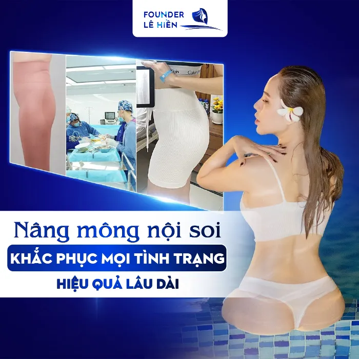 Nâng Mông Nội Soi