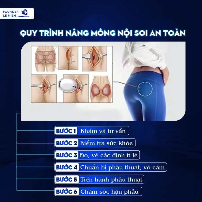 Nâng Mông Nội Soi