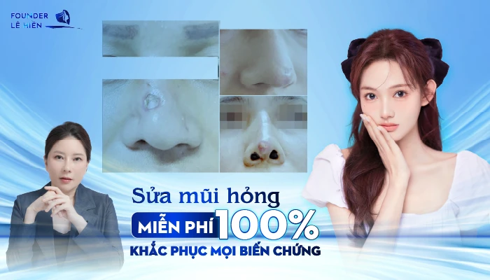 Sửa Mũi Hỏng Miễn Phí 100% Khắc Phục Mọi Biến Chứng