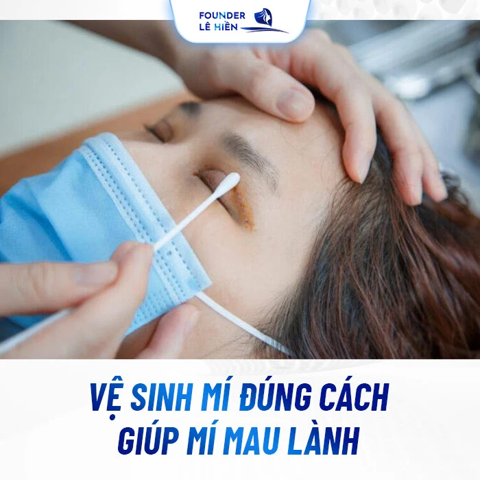 Sửa mí hỏng