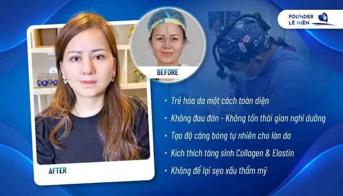 Căng da mặt bằng chỉ trẻ hóa Firin Nano Collagen là sự lựa chọn không thể bỏ qua khi bạn đang có nhu cầu trẻ hóa làn da