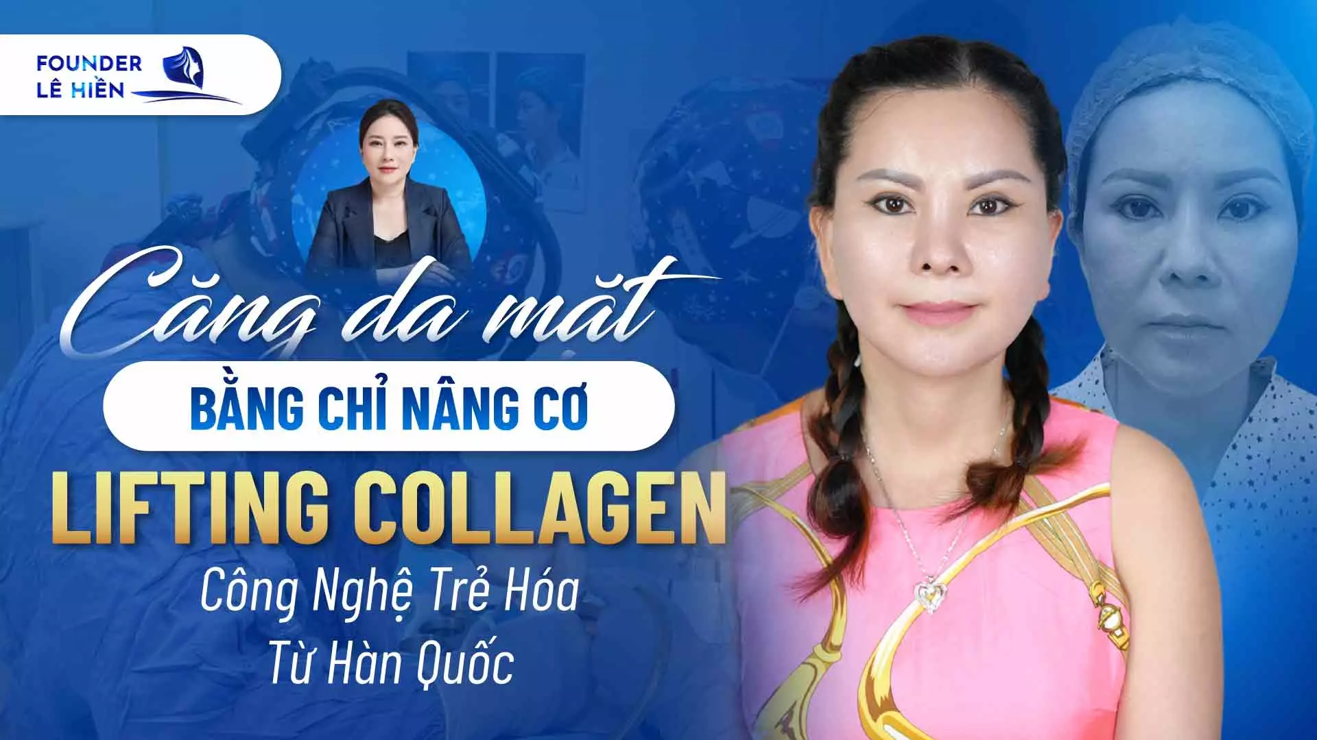 Căng Da Mặt Bằng Chỉ Nâng Cơ Lifting Collagen: Công Nghệ Trẻ Hóa Từ Hàn Quốc