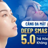 cang-da-mat-deep-smas-laser-5-0 (2)