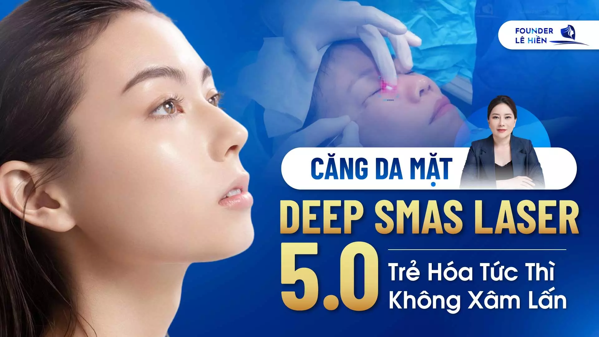 cang da mat deep smas laser 5 0 2