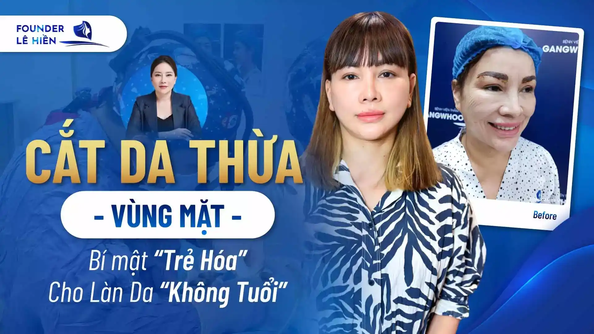 cat da thua vung mat 2 1