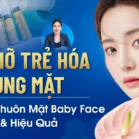 cay-mo-tre-hoa-vung-mat (2)