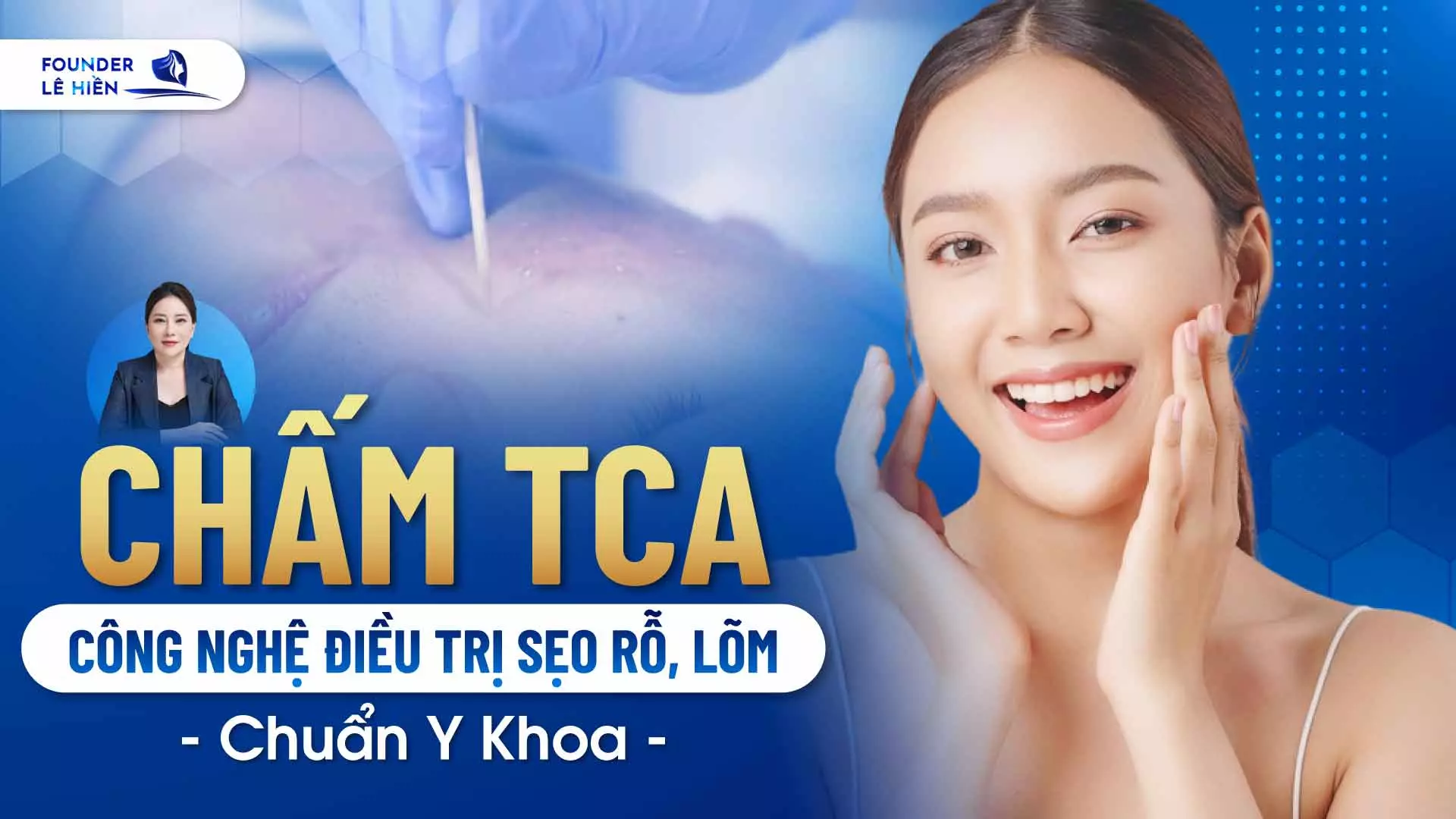 cham tca 2 1