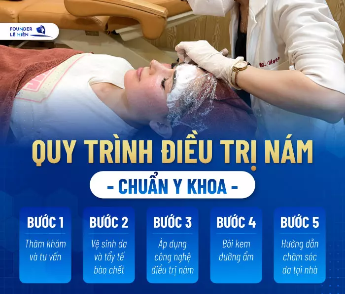 Quy trình điều trị nám chuẩn Y khoa