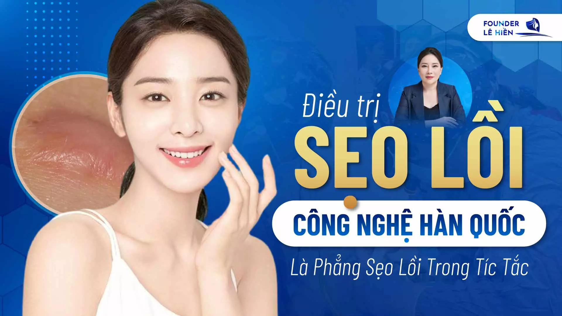 dieu tri seo loi 2