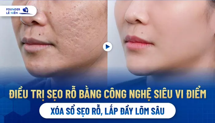 Công nghệ siêu vi điểm là bước tiến vượt bậc trong lĩnh vực thẩm mỹ da