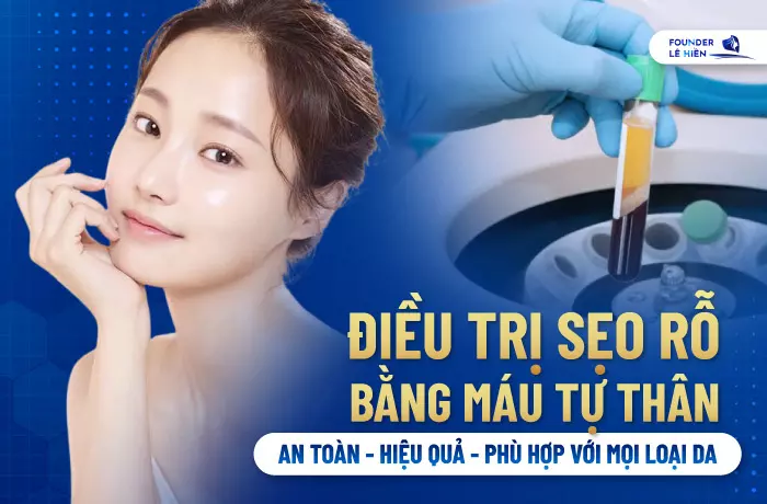 Máy quay li tâm sẽ tách và lấy huyết tương có nhiều tiểu cầu, gấp 8 – 10 lần bình thường (khoảng 94% tiểu cầu).