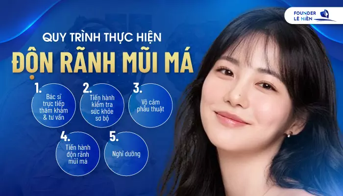 Độn rãnh mũi má là công nghệ làm đẹp hiện đại và an toàn tại bệnh viện thẩm mỹ của Founder Lê Hiền