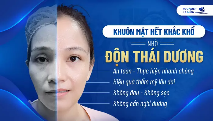 Độn thái dương là phương pháp làm đẹp được nhiều chị em lựa chọn vì nhiều ưu điểm nổi trội