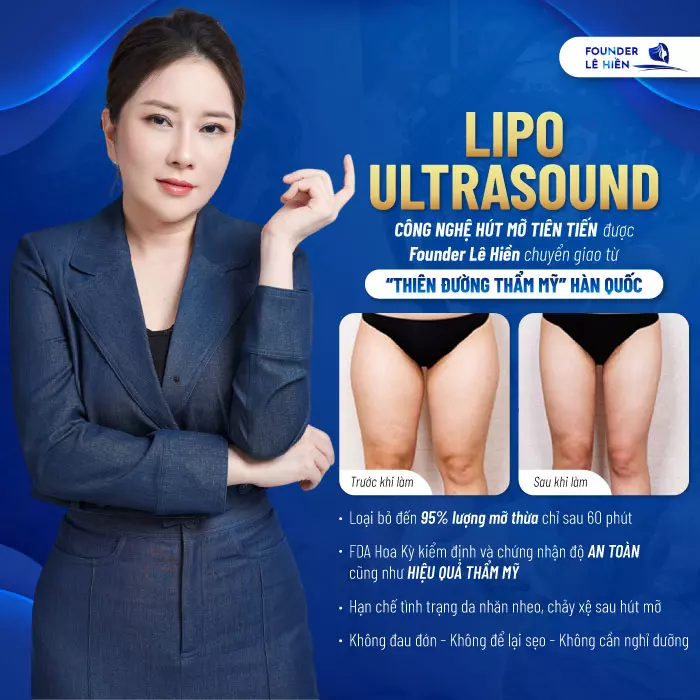 Công nghệ hút mỡ Lipo Ultrasound - Giải pháp hoàn hảo cho vóc dáng thon gọn