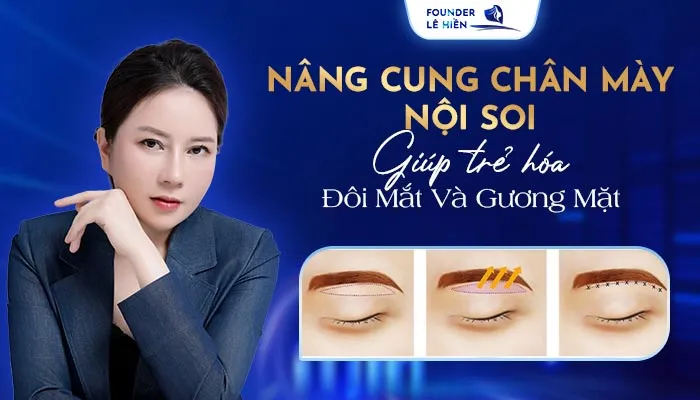 nang cung chan may noi soi