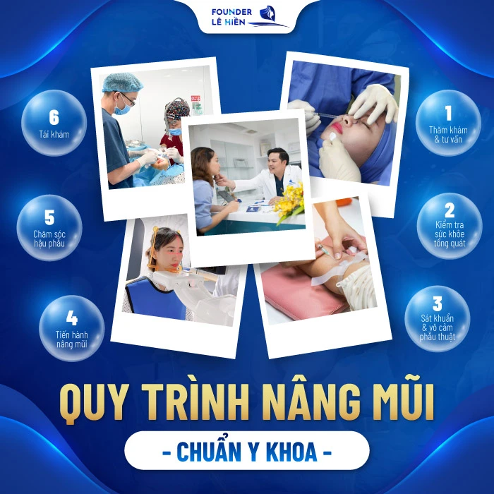 Quy trình 6 bước nâng mũi chuẩn Y khoa
