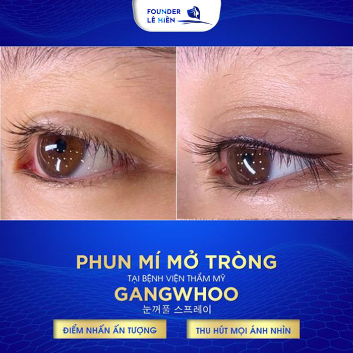 Tạo điểm nhấn cho đôi mắt với phun mí mở tròng