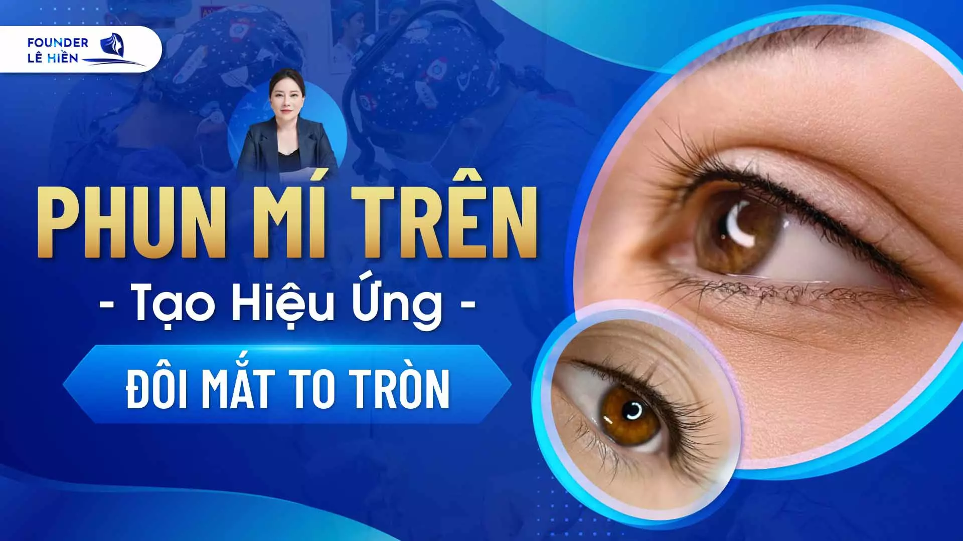 Phun Mí Trên - Tạo Hiệu Ứng Đôi Mắt To Tròn