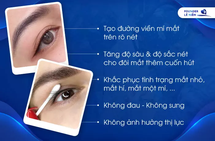 Phun mí mắt trên phù hợp cho những đối tượng khách hàng có khuyết điểm mí mắt lót, mí không rõ