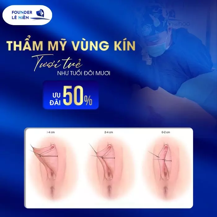 BVTM của Founder Lê Hiền thường xuyên có nhiều ƯU ĐÃI hấp dẫn