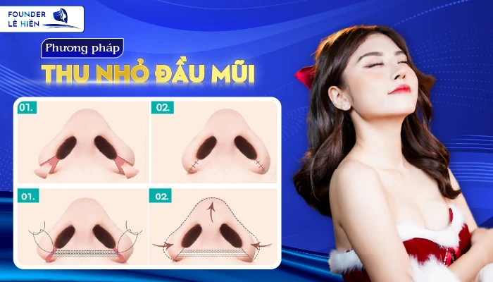 Phương pháp thu nhỏ đầu mũi được thực hiện như thế nào?