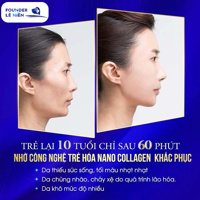 Các phương pháp xóa trẻ hóa da thông thường không tiếp cận sâu vào lớp biểu bì như Nano Collagen