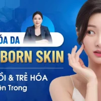 tre-hoa-da-new-born-skin (2)