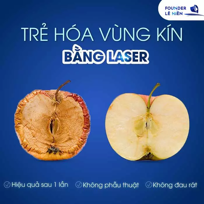 Trẻ hóa vùng kín bằng laser đã trở thành phương pháp thẩm mỹ vùng kín tiên tiến