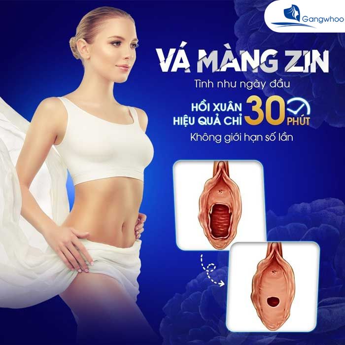 Vá màng trinh, hay còn được gọi là Hymen-Repair hoặc Hymenoplasty