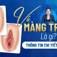 va-mang-trinh