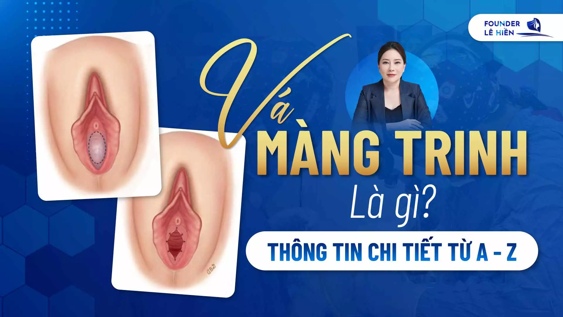 va mang trinh