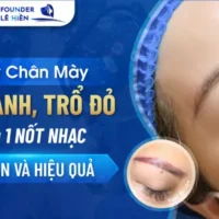 xu-ly-chan-may-bị-hu-5