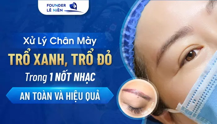 Xử Lý Chân Mày Trổ Xanh Trổ Đỏ Trong 1 Nốt Nhạc - An Toàn & Hiệu Quả