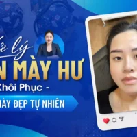 xu-ly-chan-may-hu (2)