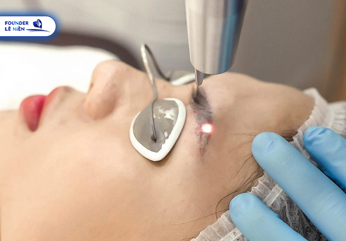 Laser có bước sóng thông minh phá huỷ và loại bỏ hoàn toàn màu mực bị trổ xanh, đỏ