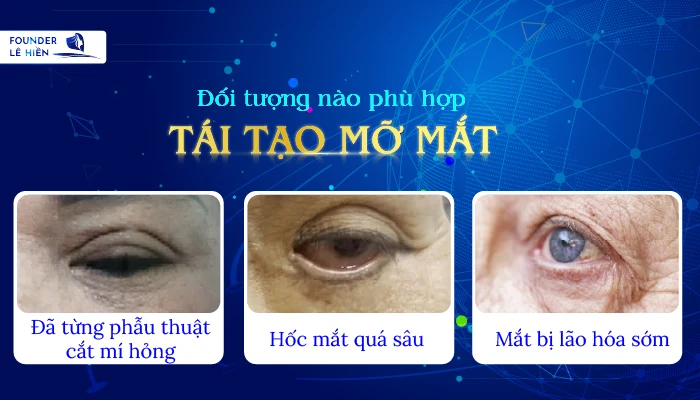 Tái tạo mỡ mắt