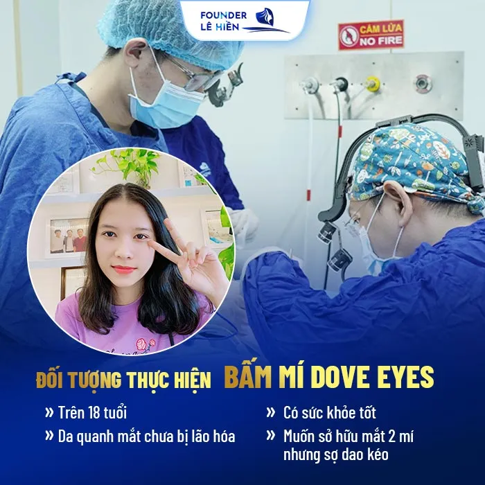 Bấm mí Dove Eyes