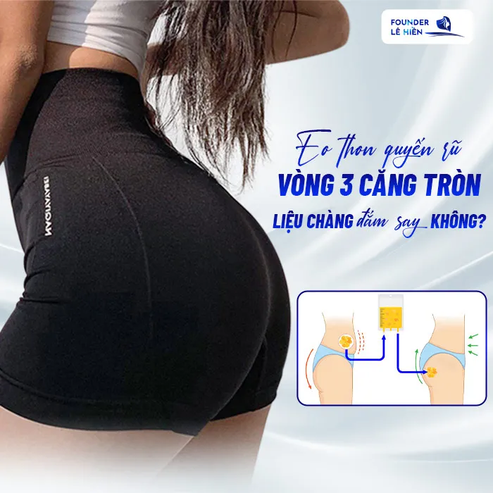 Nâng mông bằng mỡ tự thân