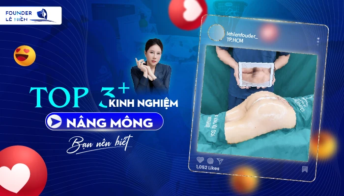 Kinh Nghiem Nang Mong Ban Nen Biet 01
